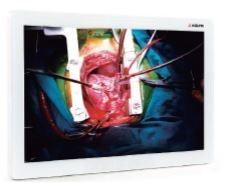 ADLINK/PENTA ASM32U-T 31,5  4K Surgical Touch-Monitor